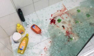Comportamento: Relato de mulher sobre queda de box de vidro em filho viraliza nas redes sociais