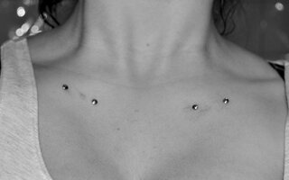 Microdermal