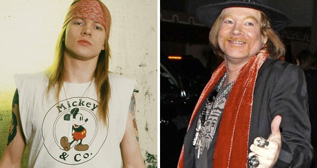 Axl Rose