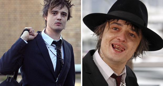 Pete Doherty