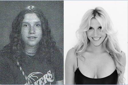 11. Kesha